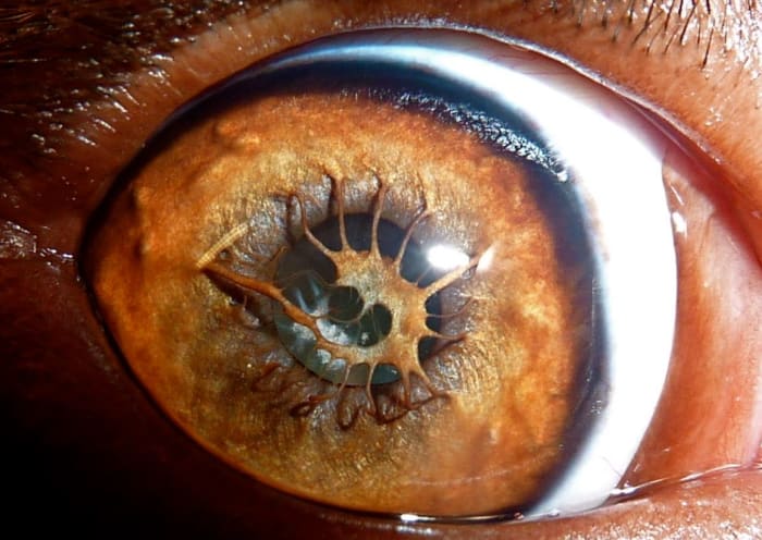 A 9 months old male Kurzhaar dog with hyperplastic persistent pupillary membrane (HPPM), Author, Pier Luigi Dodi, Creative CommonsundefinedAttribution-Share Alike 4.0 International