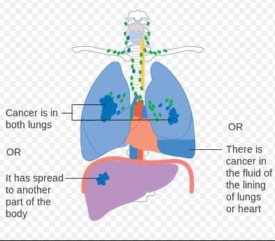 Symptoms of End Stage Lung Cancer in Dogs - Dog Discoveries