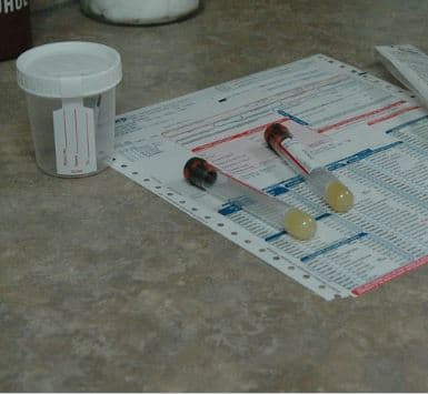 The vet will also order some universal tests like blood analysis (complete blood count and biochemistry profile) to determine the dog’s overall health.
