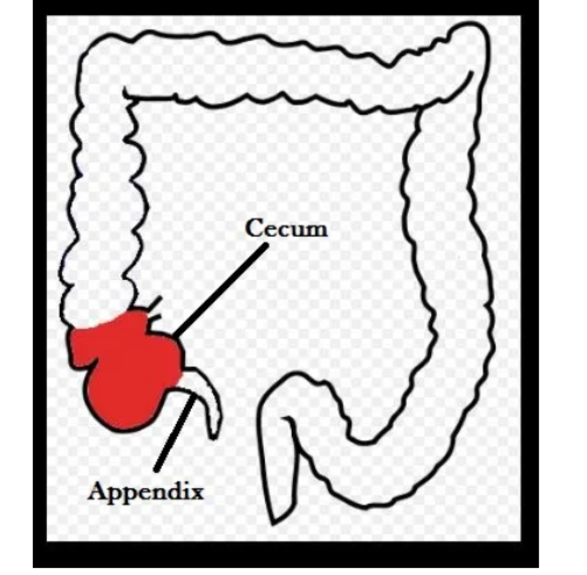Dogs don't have an appendix, but they have the cecum