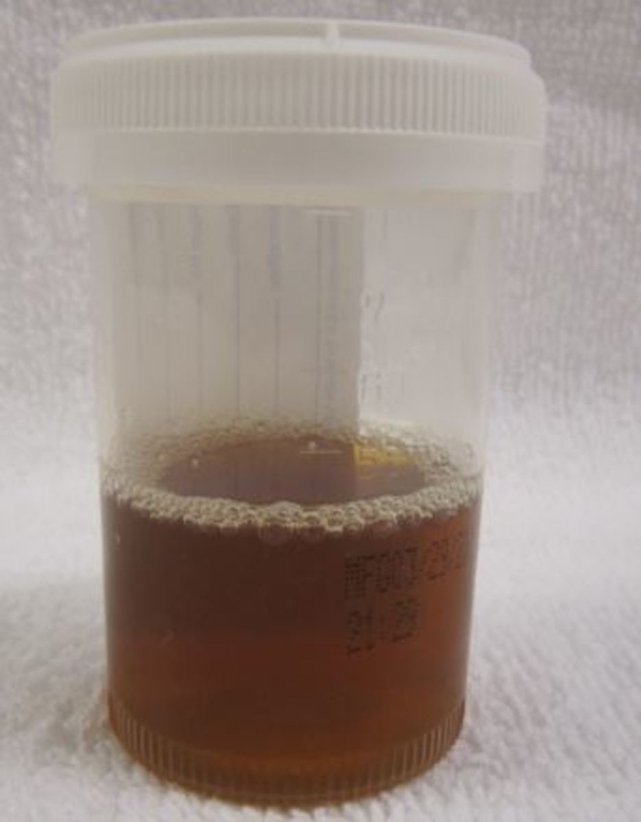 dog urine sample