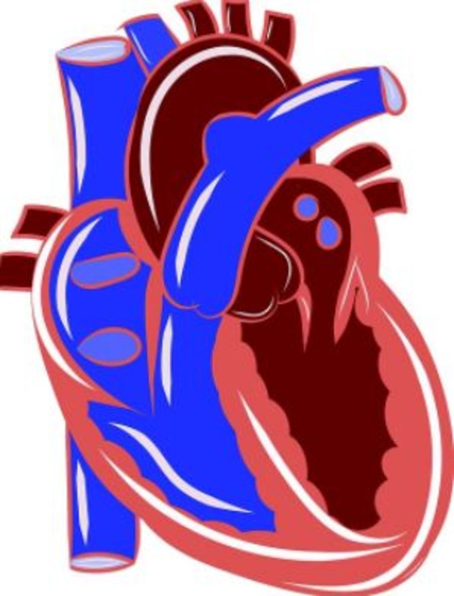 Clogged arteries leading to heart disease is mostly seen in humans.