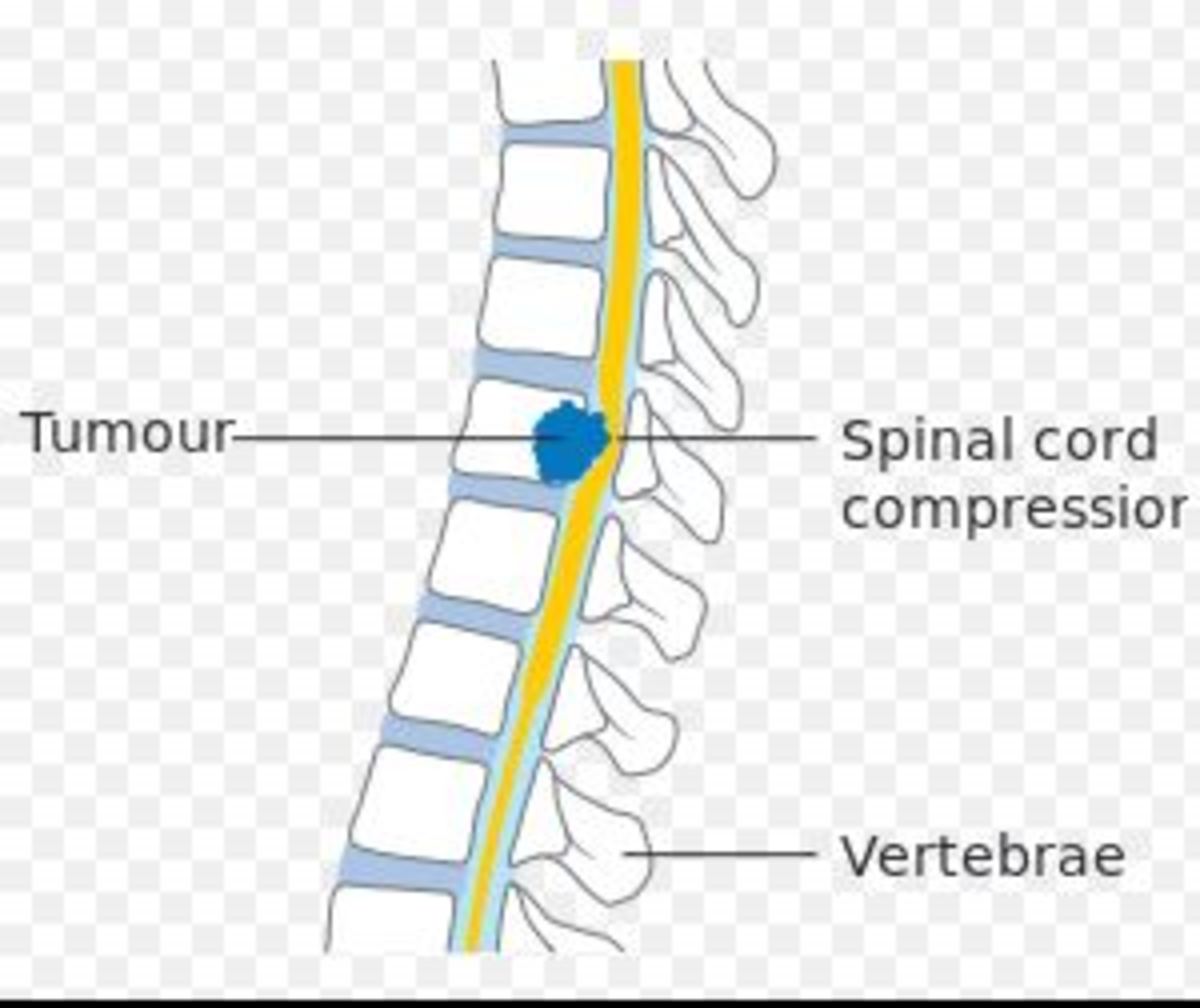 spinal cord dog