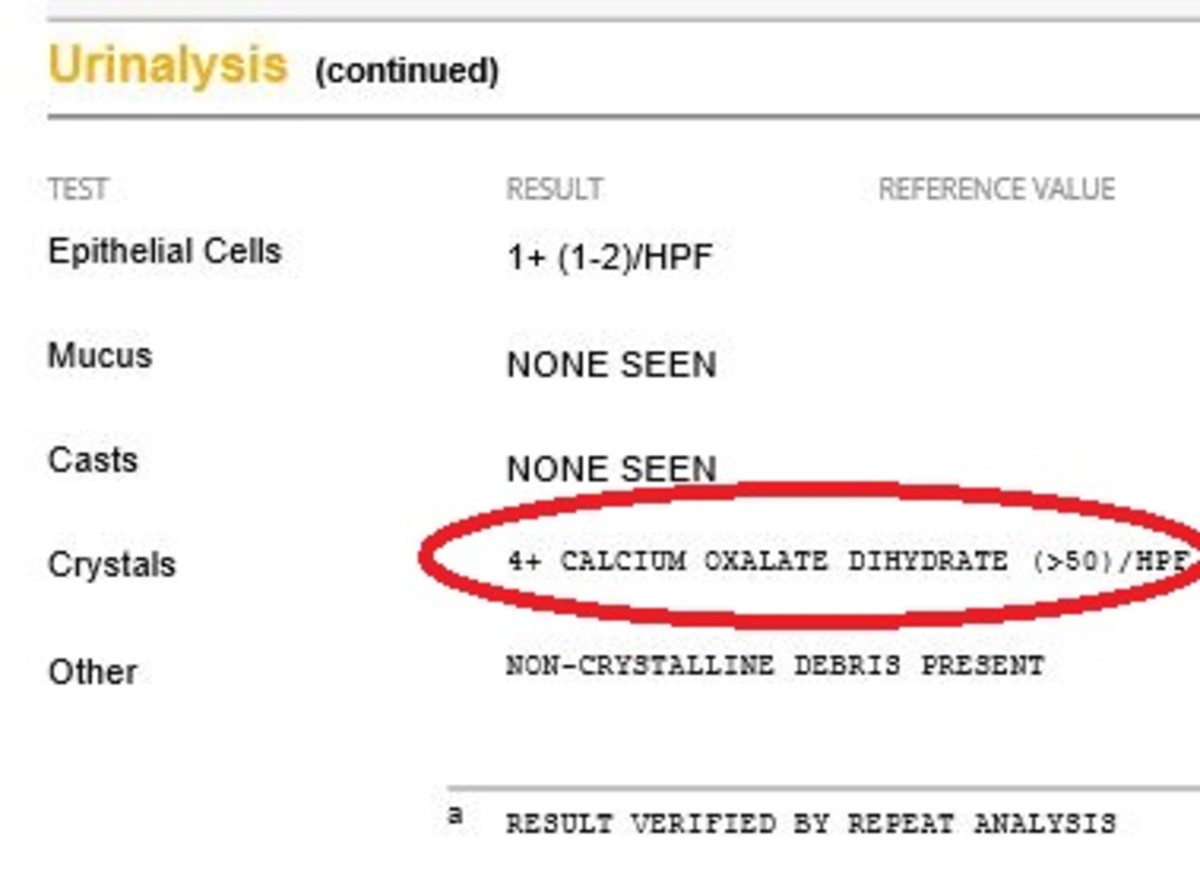 what causes calcium oxalate crystals in urine in dogs